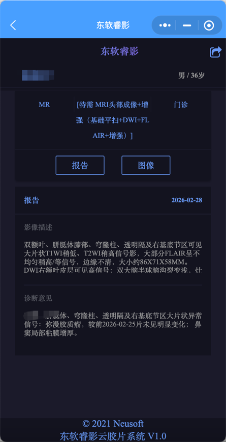 da7e0e6e696ea6928a90f4ccb61656b0.png